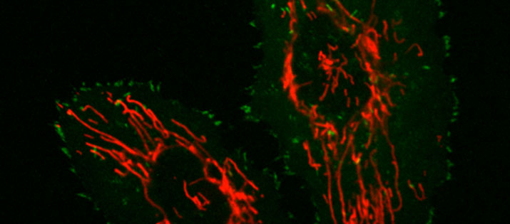 RFP Mitochondria