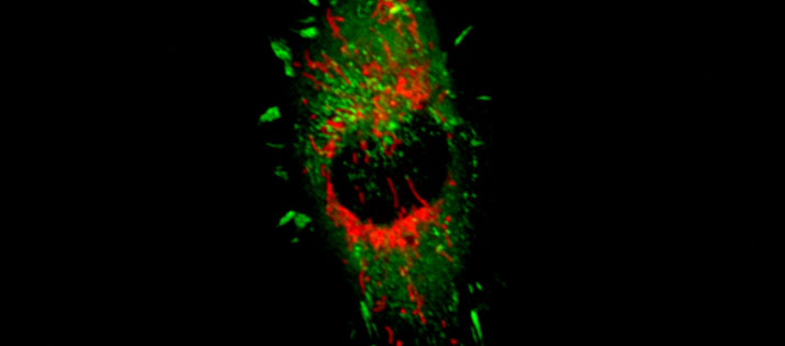 RFP Mitochondria