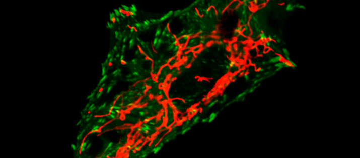 RFP Mitochondria